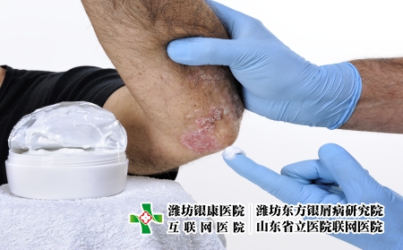 摄图网_503148875_用手套保护双手的皮肤科医生用乳膏治疗患有银屑病的成年男（企业商用）