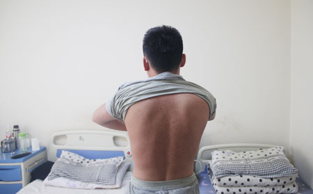 写给牛皮癣患者家属的话