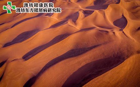 牛皮癣会不会传染?
