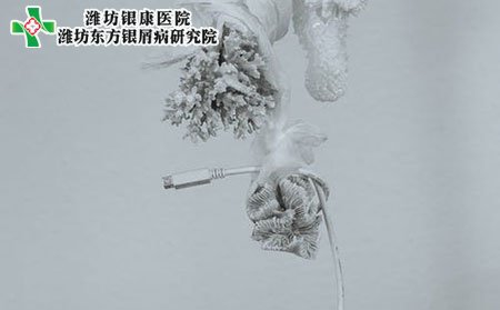 牛皮癣患者秋冬季节应该注意些什么?